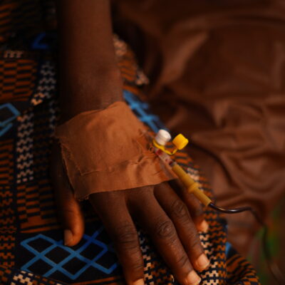A woman with a cannula in her hand receives a blood transfusion.